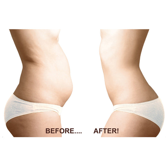 BodyEase Cryotherapie Vet Vriezer — afbeelding 2