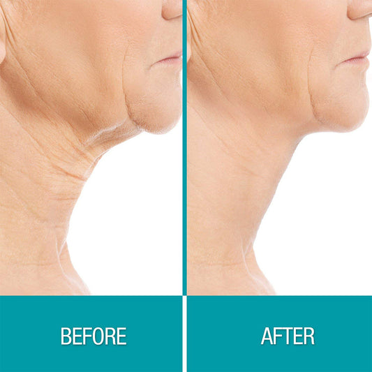 BodyEase Chin Sculpt — afbeelding 2